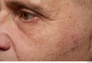  HD Face skin references Saahir Nasir cheek eye eyebrow pores skin texture wrinkles 0001.jpg